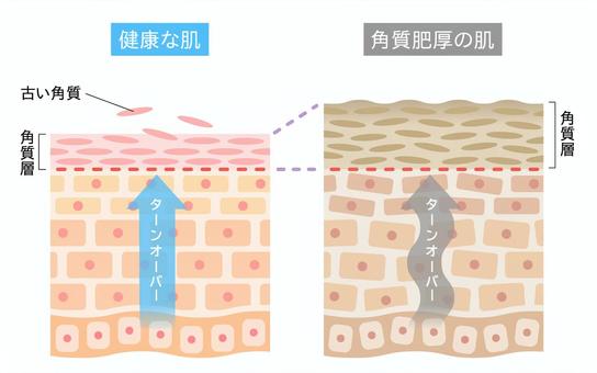 体調不良と皮膚との関係